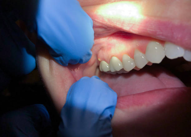 Best Emergency Treatment for Jaw Pain or Injury in Gerald, MO
