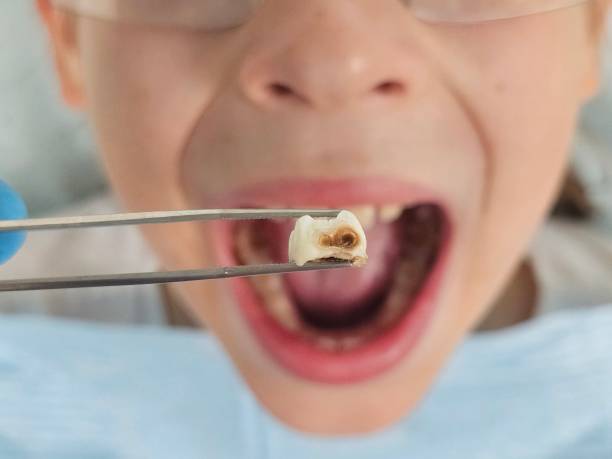 Best Urgent Dental Care for Toothaches in Gerald, MO